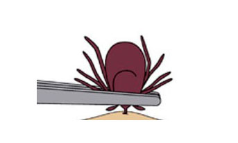 Tick removal