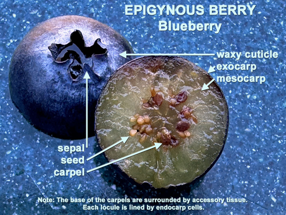 Epigynous Berry (Blueberry) Cross-section