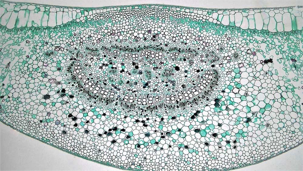 Ficus leaf cross-section in which the vascular bundles of the petiole and midrib are "leptocentric with a ring of xylem surrounding central phloem” wrapped in parenchymatous bundle sheaths. Photo courtesy of Berkshire Community College Bioscience Image Library